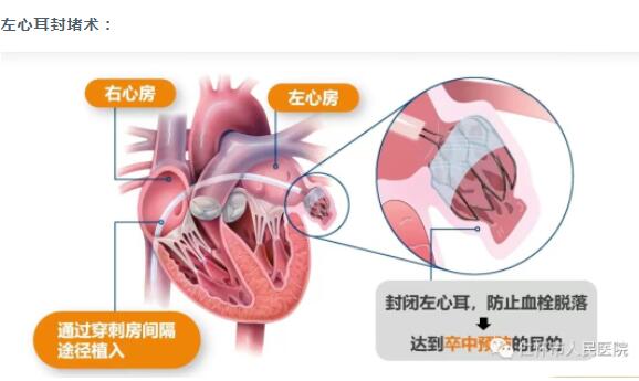 QQ截图20230616162034.jpg